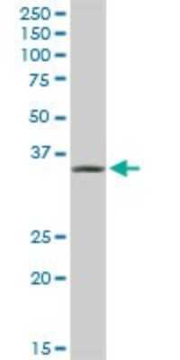Western Blot: AKR1A1 Antibody [H00010327-D01P] - Analysis of AKR1A1 expression in human colon.