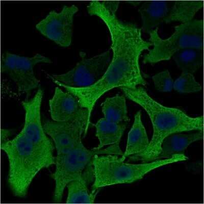 Immunocytochemistry/Immunofluorescence: AKR1B1 Antibody (CPTC-AKR1B1-2) - Azide and BSA Free [NBP2-79931] - Immunofluorescence Analysis of A549 cells labeling AKR1B1 with AKR1B1 Antibody (CPTC-AKR1B1-2) followed by Goat anti-Mouse IgG-CF488 (Green). The nuclear counterstain is RedDot (Blue)