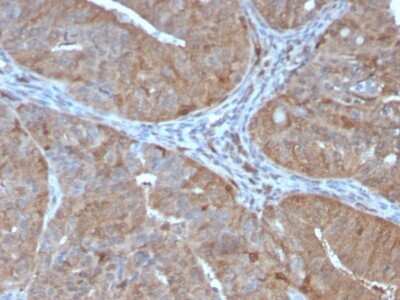 Immunohistochemistry-Paraffin: AKR1B1 Antibody (CPTC-AKR1B1-2) - Azide and BSA Free [NBP2-79931] - Formalin-fixed, paraffin-embedded human prostate stained with AKR1B1 Antibody (CPTC-AKR1B1-2).