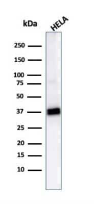 Western Blot: AKR1B1 Antibody (CPTC-AKR1B1-2) - Azide and BSA Free [NBP2-79931] - Western Blot Analysis of HeLa cell lysate usingAKR1B1 Antibody (CPTC-AKR1B1-2).