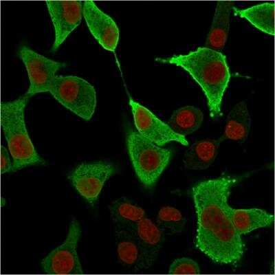 Immunocytochemistry/Immunofluorescence: AKR1B1 Antibody (CPTC-AKR1B1-3) - Azide and BSA Free [NBP2-79930] - Immunofluorescence Analysis of A549 cells labeling AKR1B1 with AKR1B1 Mouse Monoclonal Antibody (CPTC-AKR1B1-3) followed by Goat anti-Mouse IgG-CF488 (Green). The nuclear counterstain is Redot (Red).