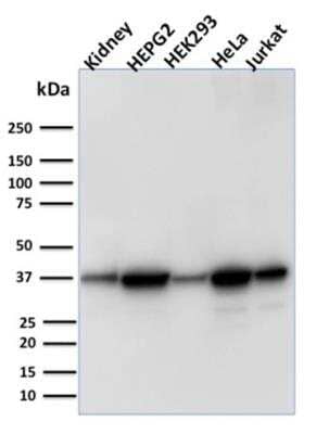 Western Blot: AKR1B1 Antibody (CPTC-AKR1B1-3) - Azide and BSA Free [NBP2-79930] - Western Blot Analysis of Human Kidney tissue, Human HepG2, HEK293, HeLa and Jurkat cell lysate using AKR1B1 Mouse Monoclonal Antibody (CPTC-AKR1B1-3).