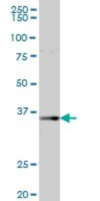 Western Blot: AKR1B1 Antibody [H00000231-B01P] - Analysis of AKR1B1 expression in human kidney.
