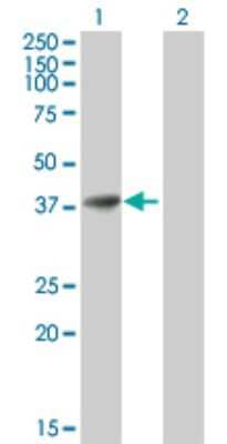 Western Blot: AKR1B1 Antibody [H00000231-B01P] - Analysis of AKR1B1 expression in transfected 293T cell line by AKR1B1 polyclonal antibody.  Lane 1: AKR1B1 transfected lysate(34.76 KDa). Lane 2: Non-transfected lysate.