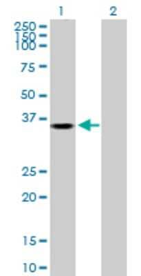 Western Blot: AKR1B1 Antibody [H00000231-D01P] - Analysis of AKR1B1 expression in transfected 293T cell line by AKR1B1 polyclonal antibody.Lane 1: AKR1B1 transfected lysate(35.90 KDa).Lane 2: Non-transfected lysate.