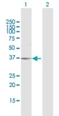 Western Blot: AKR1B1 Antibody [H00000231-D02P] - Analysis of AKR1B1 expression in transfected 293T cell line by AKR1B1 polyclonal antibody.Lane 1: AKR1B1 transfected lysate(34.76 KDa).Lane 2: Non-transfected lysate.