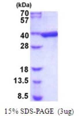 SDS-Page: AKR1B1 Recombinant Protein [NBP2-51989] - 15% SDS Page (3 ug)