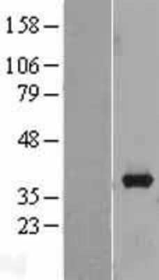 Western Blot: Aldo-keto Reductase 1B10/AKR1B10 Overexpression Lysate [NBL1-07434] -  Left-Empty vector transfected control cell lysate (HEK293 cell lysate); Right -Over-expression Lysate for AKR1B10.