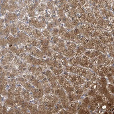 Immunohistochemistry-Paraffin: Aldo-keto Reductase 1C4/AKR1C4 Antibody [NBP2-14277] -  Staining of human liver shows moderate cytoplasmic positivity in hepatocytes.