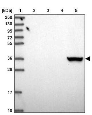 Western Blot: Aldo-keto Reductase 1C4/AKR1C4 Antibody [NBP2-14277] - Lane 1: Marker  [kDa] 250, 130, 95, 72, 55, 36, 28, 17, 10.  Lane 2: Human cell line RT-4.  Lane 3: Human cell line U-251MG sp.  Lane 4: Human plasma (IgG/HSA depleted).  Lane 5: Human liver tissue