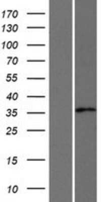 Western Blot AKR1CL2 Overexpression Lysate