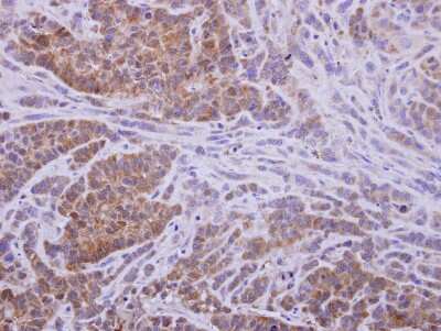 Immunohistochemistry-Paraffin: AKR1D1 Antibody [NBP2-15323] - Paraffin-embedded A549 xenograft, using antibody at 1:500 dilution.