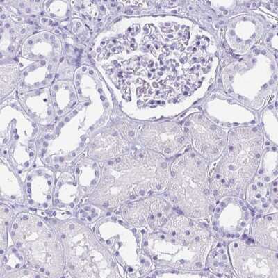 Immunohistochemistry-Paraffin: AKR1D1 Antibody [NBP2-33811] - Staining of human kidney shows low expression as expected.