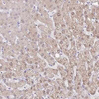 Immunohistochemistry-Paraffin: AKR1D1 Antibody [NBP2-33811] - Staining of human liver shows high expression.