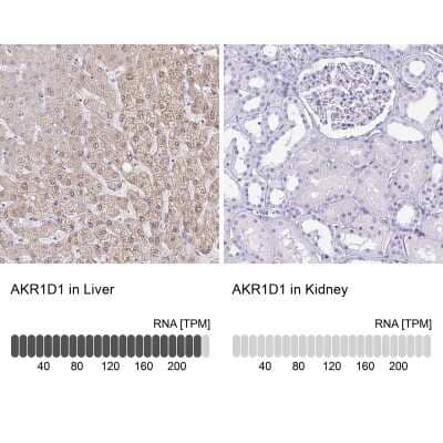 <b>Orthogonal Strategies Validation. </b>Immunohistochemistry-Paraffin: AKR1D1 Antibody [NBP2-33811] - Staining in human liver and kidney tissues using anti-AKR1D1 antibody. Corresponding AKR1D1 RNA-seq data are presented for the same tissues.