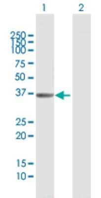 Western Blot: AKR1D1 Antibody [H00006718-B01P] - Analysis of AKR1D1 expression in transfected 293T cell line by AKR1D1 polyclonal antibody.  Lane1:AKR1D1 transfected lysate(35.86 KDa). Lane2:Non-transfected lysate.