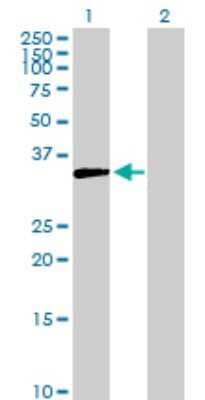 Western Blot: AKR1D1 Antibody [H00006718-D01P] - Analysis of AKR1D1 expression in transfected 293T cell line by AKR1D1 polyclonal antibody.Lane 1: AKR1D1 transfected lysate(37.40 KDa).Lane 2: Non-transfected lysate.