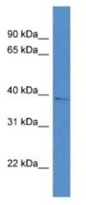 Western Blot: AKR1D1 Antibody [NBP1-74082] - RPMI-8226 Cell Lysate 1ug/ml  Gel Concentration 12%