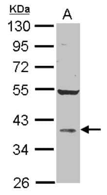 Western Blot: AKR1D1 Antibody [NBP2-21603] - Sample (30 ug of whole cell lysate) A: A549 10% SDS PAGE gel, diluted at 1:1000.