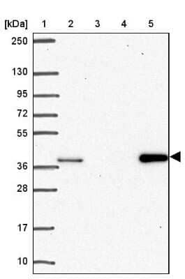 Western Blot: AKR1D1 Antibody [NBP2-33811] - Lane 1: Marker  [kDa] 250, 130, 95, 72, 55, 36, 28, 17, 10.  Lane 2: Human cell line RT-4.  Lane 3: Human cell line U-251MG sp.  Lane 4: Human plasma (IgG/HSA depleted).  Lane 5: Human liver tissue