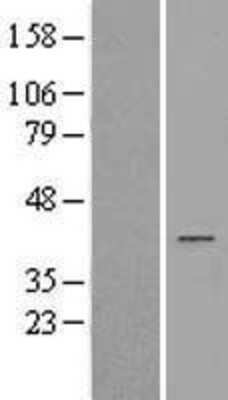 Western Blot: AKR1D1 Overexpression Lysate (Adult Normal) [NBL1-07438] Left-Empty vector transfected control cell lysate (HEK293 cell lysate); Right -Over-expression Lysate for AKR1D1.