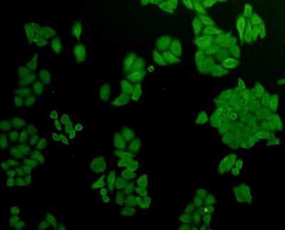 Immunocytochemistry/Immunofluorescence: AKR7A2 Antibody (C10-D5) [NBP2-67126] - Staining AKR7A2 in HepG2 cells (green). Cells were fixed in paraformaldehyde, permeabilised with 0.25% Triton X100/PBS.