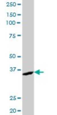Western Blot: AKR7A2 Antibody [H00008574-B01P] - Analysis of AKR7A2 expression in human stomach.