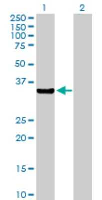 Western Blot: AKR7A2 Antibody [H00008574-D01P] - Analysis of AKR7A2 expression in transfected 293T cell line by AKR7A2 polyclonal antibody.Lane 1: AKR7A2 transfected lysate(36.60 KDa).Lane 2: Non-transfected lysate.