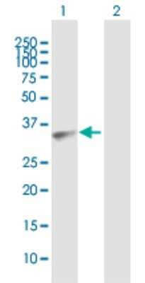 Western Blot: AKR7A3 Antibody [H00022977-B01P] - Analysis of AKR7A3 expression in transfected 293T cell line by AKR7A3 polyclonal antibody.  Lane 1: AKR7A3 transfected lysate(36.41 KDa). Lane 2: Non-transfected lysate.