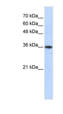 Western Blot: AKR7A3 Antibody [NBP1-56768] - Transfected 293T cell lysate, concentration 0.2-1 ug/ml.