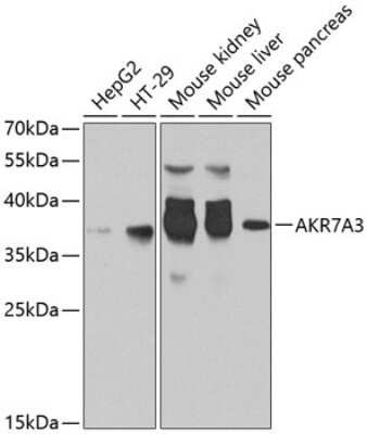 Western Blot: AKR7A3 Antibody [NBP2-92684] - Analysis of extracts of various cell lines, using AKR7A3 at 1:1000 dilution.Secondary antibody: HRP Goat Anti-Rabbit IgG (H+L) at 1:10000 dilution.Lysates/proteins: 25ug per lane.Blocking buffer: 3% nonfat dry milk in TBST.Detection: ECL Basic Kit .Exposure time: 30s.