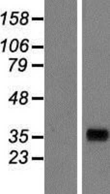 Western Blot: AKR7A3 Overexpression Lysate (Adult Normal) [NBP2-07498] Left-Empty vector transfected control cell lysate (HEK293 cell lysate); Right -Over-expression Lysate for AKR7A3.