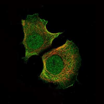 Immunocytochemistry/Immunofluorescence: AKT1 Antibody (CL0887) [NBP2-52956] - Staining of MCF7 cells using the Anti-AKT1 monoclonal antibody, showing specific staining in the nucleus, cytosol and plasma membrane in green. Microtubule- and nuclear probes are visualized in red and blue, respectively (where available).