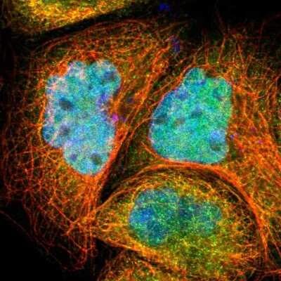 Immunocytochemistry/Immunofluorescence: AKT1 Antibody [NBP1-89159] - Immunofluorescent staining of human cell line A-431 shows localization to nucleoplasm & microtubules.