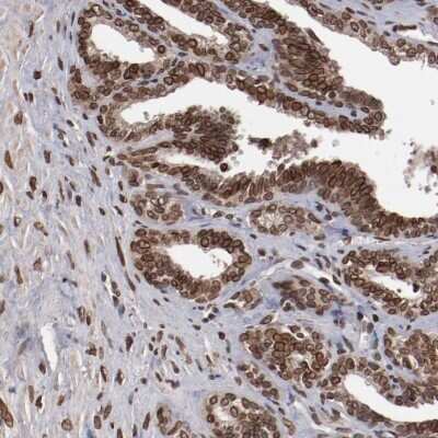 Immunohistochemistry-Paraffin: AKT1 Antibody [NBP1-89159] - IHC staining of human seminal vesicle shows high expression.