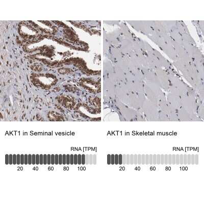 <b>Orthogonal Strategies Validation. </b>Immunohistochemistry-Paraffin: AKT1 Antibody [NBP1-89159] - IHC analysis of human seminal vesicle and skeletal muscle tissues using anti-AKT1 antibody. Corresponding AKT1 RNA-seq data are presented for the same tissues.