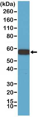 Western Blot: AKT1 Antibody (RM252) [NBP2-61479] - WB of 293 cell lysate using AKT1 antibody NBP2-61479, showed AKT1 (~56 kDa) expression.