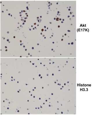 Immunohistochemistry: AKT1 Antibody (RM336) [NBP2-77406] - Staining of FFPE 293T cells transfected with a DNA construct encoding the AKT E17K mutation or Histone H3.3, stained with AKT1 E17K antibody at 0.2 ug/mL.