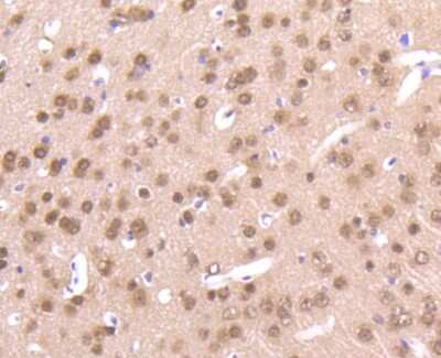 Immunohistochemistry-Paraffin: AKT1 Antibody (ST48-09) [NBP2-67523] - IHC-P analysis of paraffin-embedded mouse brain tissue using anti-AKT1/2/3 antibody. Counterstained with hematoxylin.