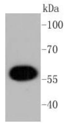 Western Blot: AKT1 Antibody (ST48-09) [NBP2-67519] - WB analysis of AKT1 on MCF-7 cell lysates using anti-AKT1 antibody at 1:1000 dilution.