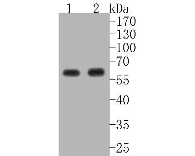 Western Blot: AKT1 Antibody (ST48-09) [NBP2-67519] - Western blot analysis of AKT1 on different lysates. Proteins were transferred to a PVDF membrane and blocked with 5% BSA in PBS for 1 hour at room temperature. The primary antibody (1/500) was used in 5% BSA at room temperature for 2 hours. Goat Anti-Rabb