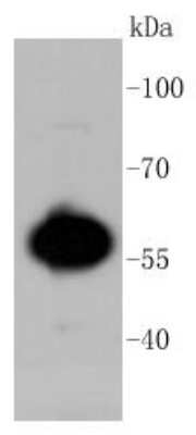 Western Blot: AKT1 Antibody (ST48-09) [NBP2-67523] - WB analysis of AKT1/2/3 on MCF-7 cell lysates using anti-AKT1/2/3 antibody at 1:1000.
