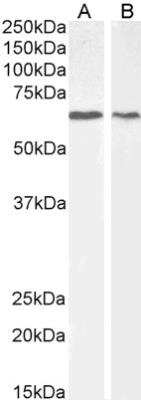 Western Blot: AKT1 Antibody [NBP2-66427] - WB of MCF7 (A) and NIH3T3 (B) cell lysates (35 ug protein in RIPA buffer). AKT1 antibody at 2 ug/mL. Detected by chemiluminescence