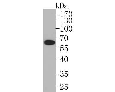 Western Blot: AKT1 [p Ser124] Antibody (JJ08-46) [NBP2-67862] - Western blot analysis of AKT1 on MCF-7 cell lysates. Proteins were transferred to a PVDF membrane and blocked with 5% BSA in PBS for 1 hour at room temperature. The primary antibody (1/500) was used in 5% BSA at room temperature for 2 hours. Goat Anti-Rab