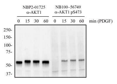 Western Blot: AKT1 [p Ser473] Antibody (104A282) - Azide and BSA Free [NBP2-27399] - Total protein from mouse 3T3 cells treated with and without PDGF (50 ng/mL) for the indicated times was separated on a 7.5% gel by SDS-PAGE, transferred to PVDF membrane and blocked in 5% non-fat milk in TBST. The membrane was probed with 2.0 ug/mL anti-AKT1 (NBP2-01725) and 2 ug/mL pS473 AKT1 in 1% BSA in TBST and detected with an anti-mouse HRP secondary antibody using chemiluminescence. Note the detection of phosphorylated AKT1 in response to PDGF treatment compared to total AKT1 protein. Image using the standard format of this product.