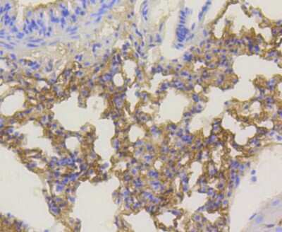Immunohistochemistry-Paraffin: AKT1 [p Ser473] Antibody (SY28-05) [NBP2-67449] - IHC-P analysis of paraffin-embedded mouse lung tissue using anti-Phospho-Akt1(Ser473) antibody. Counter-stained with hematoxylin.
