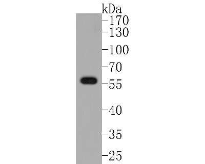 Western Blot: AKT1 [p Ser473] Antibody (SY28-05) [NBP2-67449] - Western blot analysis of AKT1 on PC-3 cell lysates. Proteins were transferred to a PVDF membrane and blocked with 5% BSA in PBS for 1 hour at room temperature. The primary antibody (1/500) was used in 5% BSA at room temperature for 2 hours. Goat Anti-Rabb