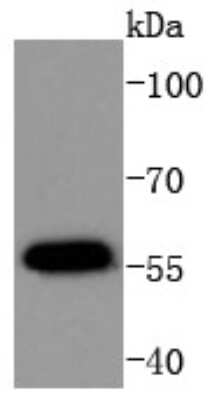 Western Blot: AKT1 [p Thr450] Antibody (SD08-12) [NBP2-67806] - WB analysis of Phospho-AKT1(Thr450) on MCF-7 cells lysates using anti-Phospho-AKT1(Thr450) antibody at 1:1000.