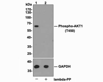 Western Blot: AKT1 [p Thr450] Antibody (SD08-12) [NBP2-67806] - Analysis of AKT1 [p Thr450] on MCF-7 cell lysates. Lane 1: MCF-7 cells, whole cell lysate, 10 ug/lane. Lane 2: MCF-7 cells treated with 2.8 ug/ul lambda-PP for 30 minutes, whole cell lysates, 10 ug/lane. Proteins were transferred to a PVDF membrane and blocked with 5% BSA in PBS for 1 hour at room temperature. The primary antibody Anti-AKT1 [p Thr450]antibody (1/1,000) , Anti-AKT1 antibody (1/5,000) and Anti-GAPDH antibody (1/10,000)was used in 5% BSA at room temperature for 2 hours. Goat Anti-Rabbit IgG H&L (HRP) Secondary Antibody at 1:200,000 dilution was used for 1 hour at room temperature. Predicted band size: 56 kDa Observed band size: 60 kDa Exposure time: 2 minutes
