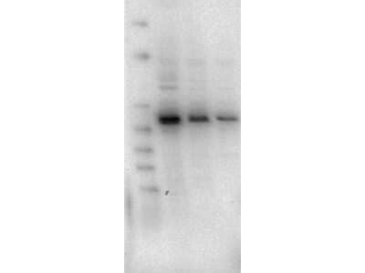 Western Blot: AKT2 Antibody (11F6.B2) [NBP2-44216] - lane 1: LnCap lysate Lane 2: Jurkat lysate. Lane 3: MDA-MB 468 lysate. Load: 5 Ug per lane.